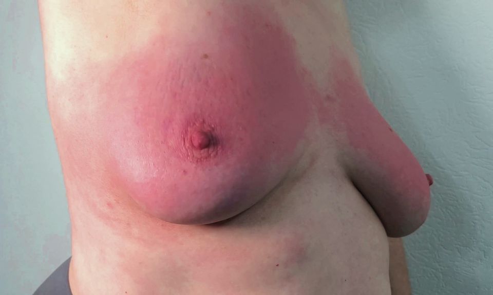 Beat your breasts painfully red until they are swollen 3-6