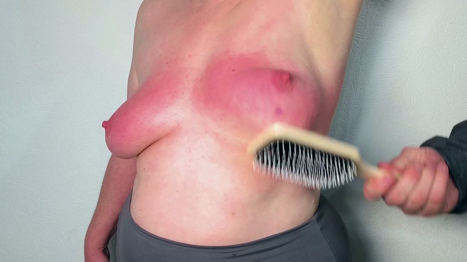 Turning your breasts painfully red until they are swollen 4-6