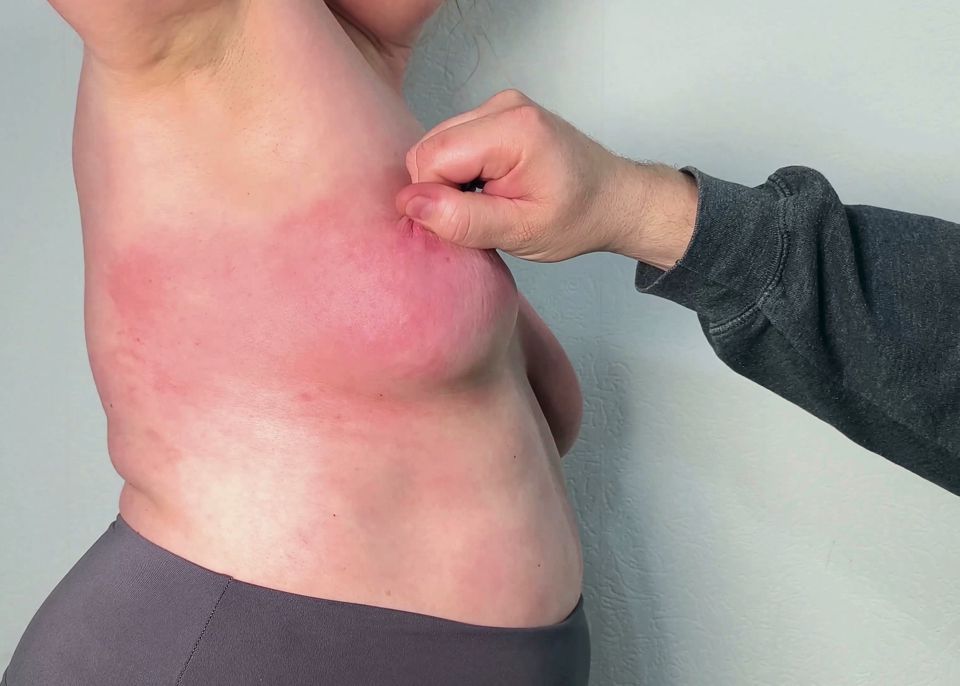 Beat your breasts painfully red until they are swollen 5-6
